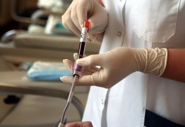 Azərbaycanda hemofiliyalı xəstələrin təsnifatlar üzrə statistikası açıqlandı
