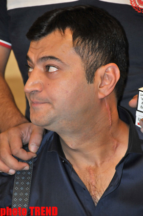 Xərçəngə qalib gələn Coşqun Rəhimov plastik əməliyyata hazırlaşır (FOTO)