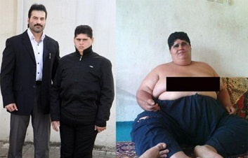 Arıqlamaq istəyənlərin nəzərinə: 9 ayda 105 kiloqram çəki azaltmaq mümkündür