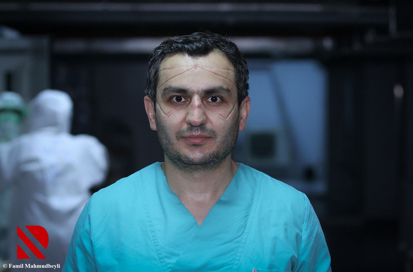 Dr.Mehdi Əliyev: Sağalan pasiyentlərimizi böyük sevinclə evə yola salırıq (FOTO)