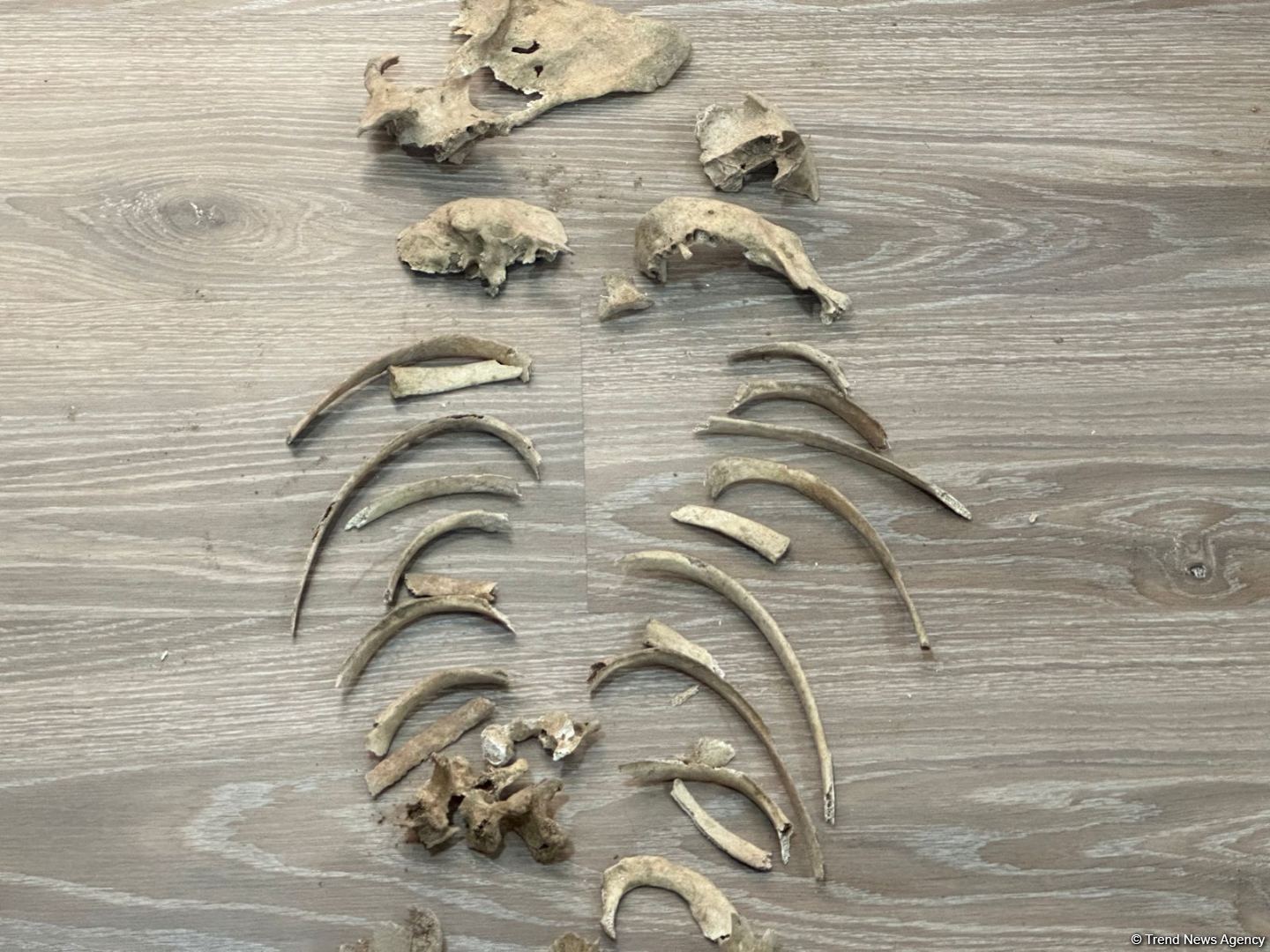 Ağdamda tapılan insan sümüklərinin görüntüsü yayılıb (FOTO)