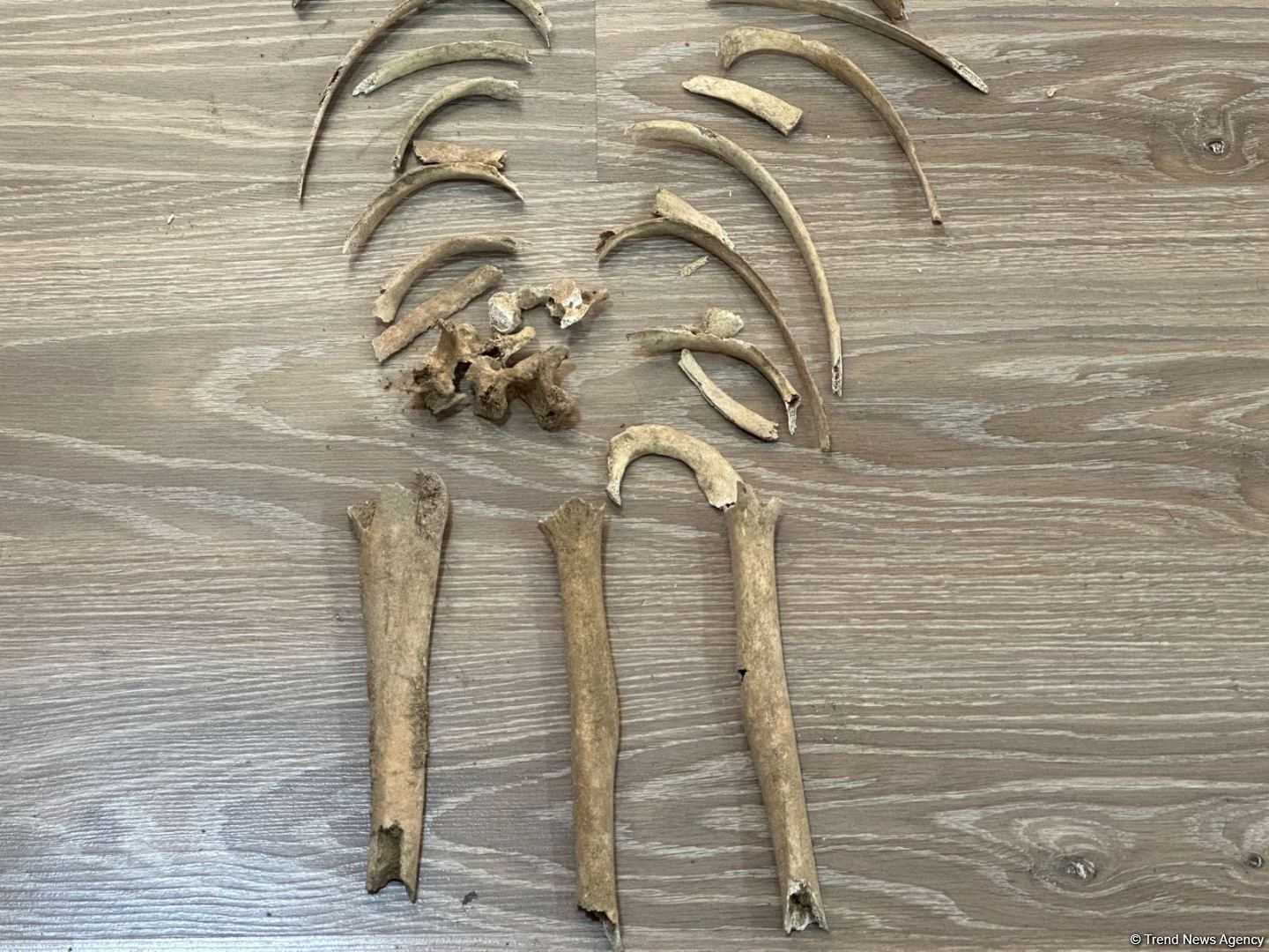 Ağdamda tapılan insan sümüklərinin görüntüsü yayılıb (FOTO)