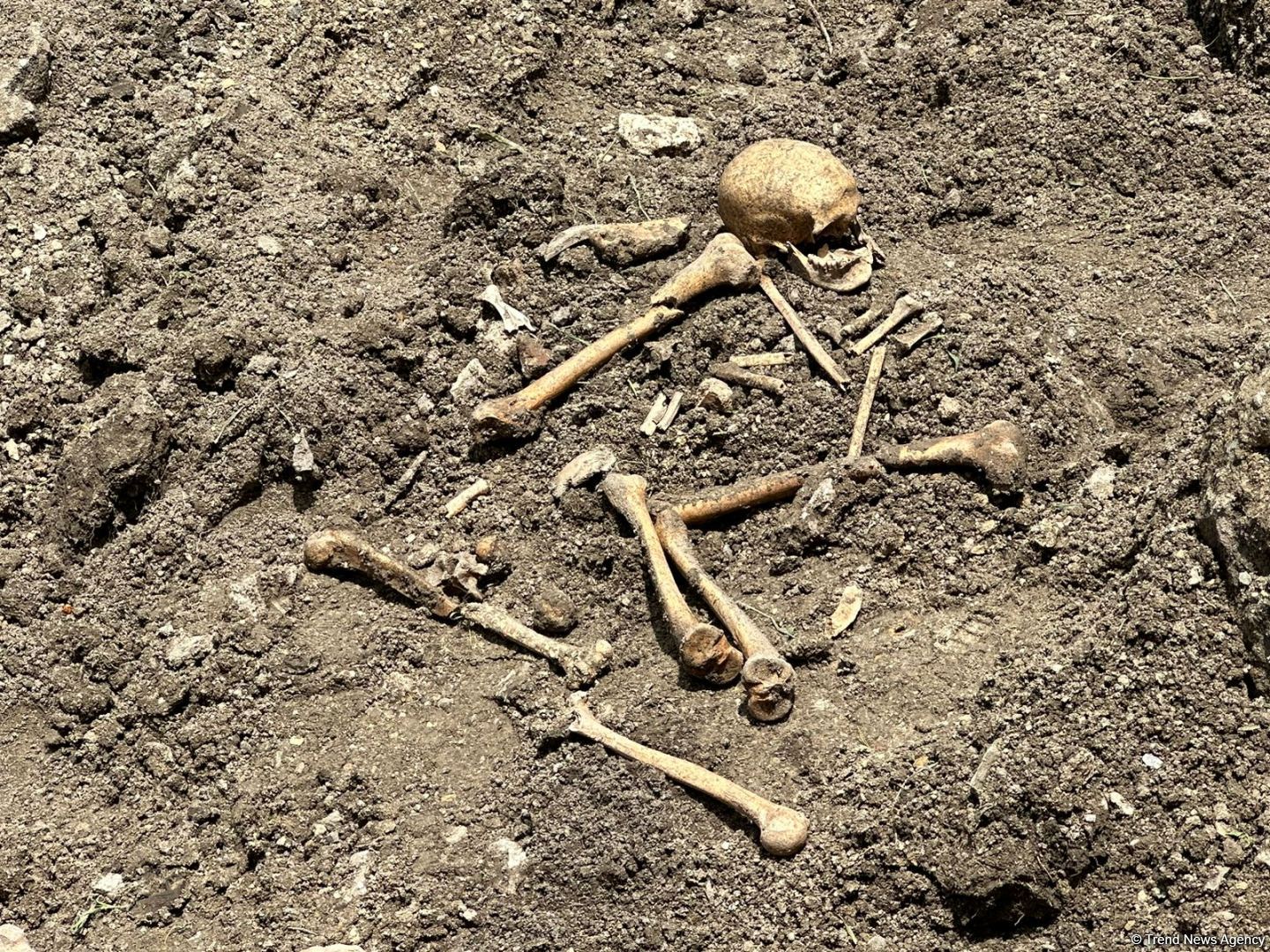 Şuşada kütləvi məzarlıq aşkarlandı (FOTO)