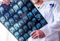 Alimlər yaddaşı 40 dəqiqəyə yaxşılaşdırmağın yolunu tapıb