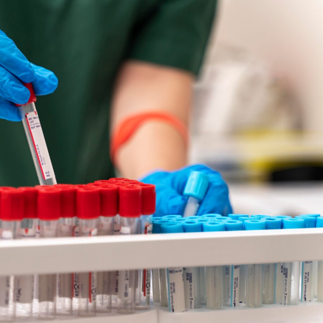 Antiretroviral müalicə İİV-ə yoluxan şəxslərdə həyat keyfiyyətini yüksəldir - Ziyad Nəsibov (FOTO)
