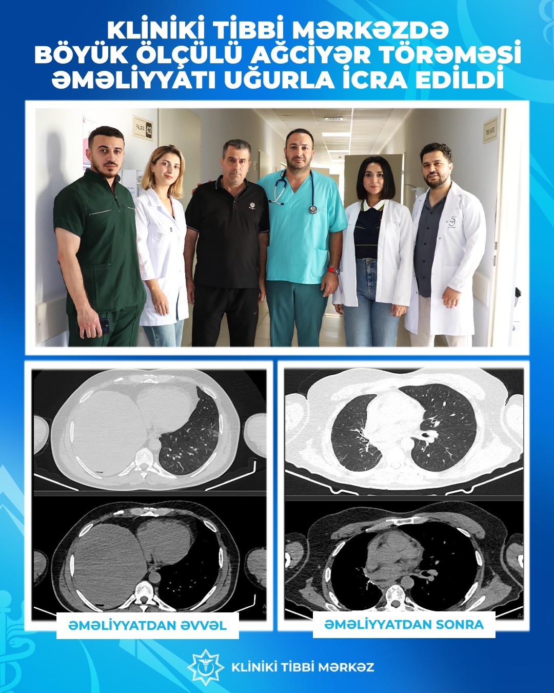 İki uzman həkim əməliyyat etdi, onkoloji xəstə sağaldı (FOTO)