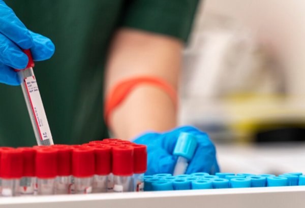 Narkomanların İİV-ə yeni yoluxma hadisələrinin sayında azalma müşahidə olunur