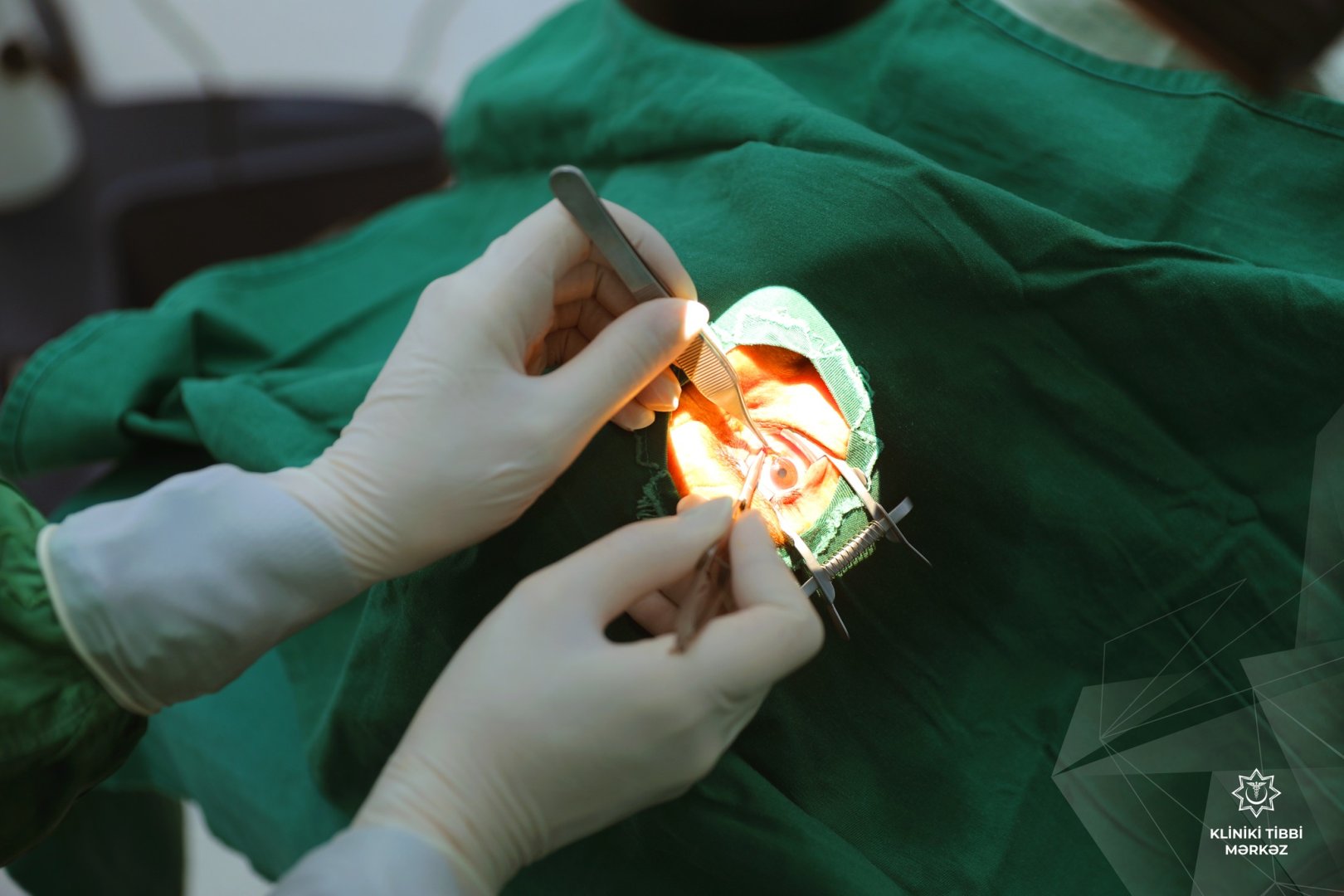 Oftalmoloji xidmətlərə nə qədər vəsaitin ayrılması gözlənilir?