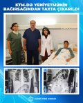 Bakıda həkimləri heyrətləndirən yeniyetmə - Bağırsağından taxta çıxdı (FOTO)