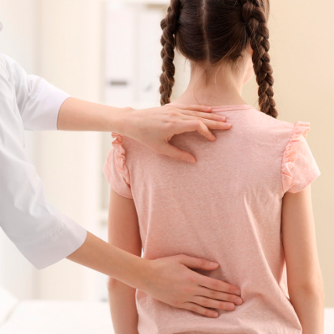 Səhiyyə Nazirliyinin mütəxəssisi uşaqlarda skoliozla bağlı valideynlərin bilməli olduğu vacib məqamları açıqladı (FOTO)