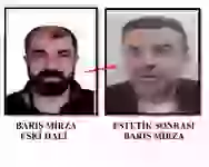 Üzünü əməliyyatla dəyişdirən cinayətkar 7 il sonra tutuldu (FOTO)